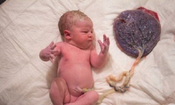 10 ασυνήθιστες φωτογραφίες που αποτυπώνουν τη «σκληρή» ομορφιά της γέννας